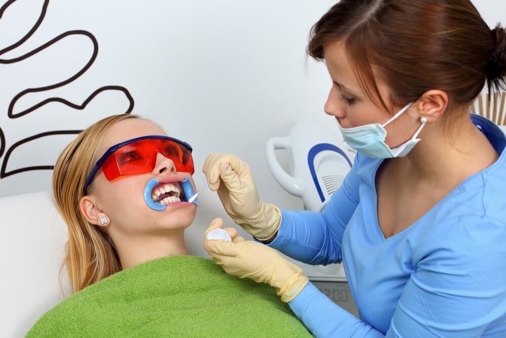 кабинетное отбеливание зубов
