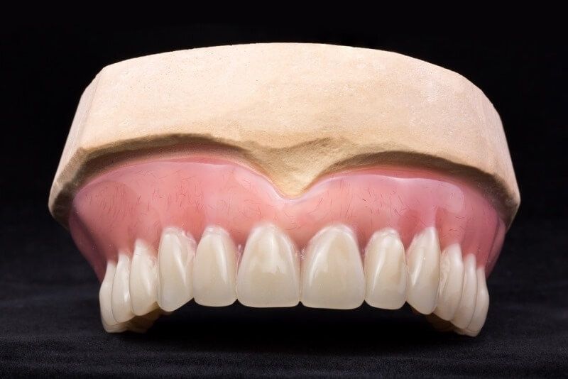 протезирование при отсутствии зубов