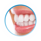 улыбка пациента после протезирования зубов