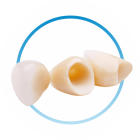 протезирования зуба после лечения каналов