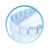 3D проектирование виниров на зубы