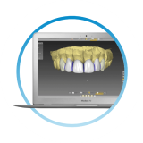 3D проектирование виниров на зубы