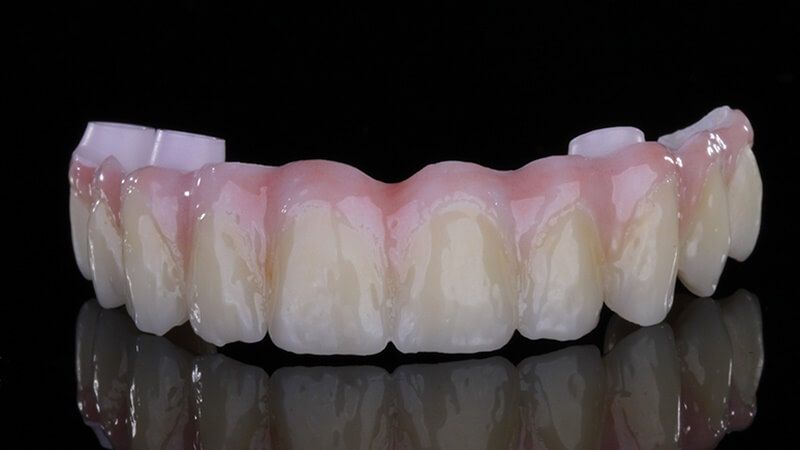 зубной ряд для протезирования "все на 4 | all-on-4" после покрытия керамикой и первого обжига