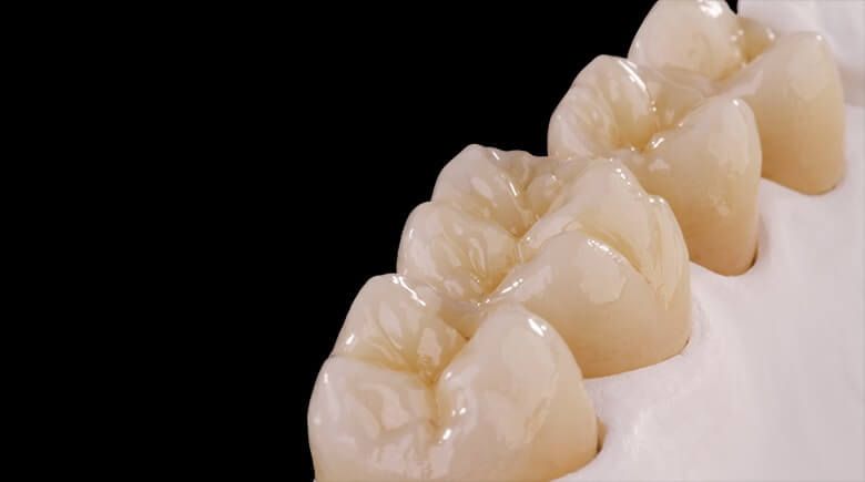 протезирование жевательных зубов коронками из циркония