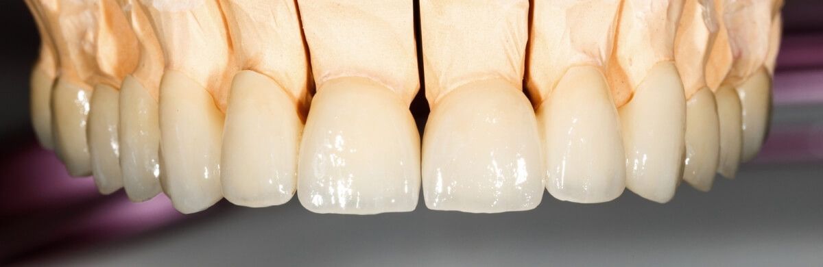 прозрачные коронки из керамики для протезирования зубов