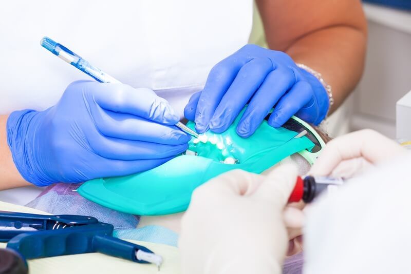 процесс обработки зубов стоматологом