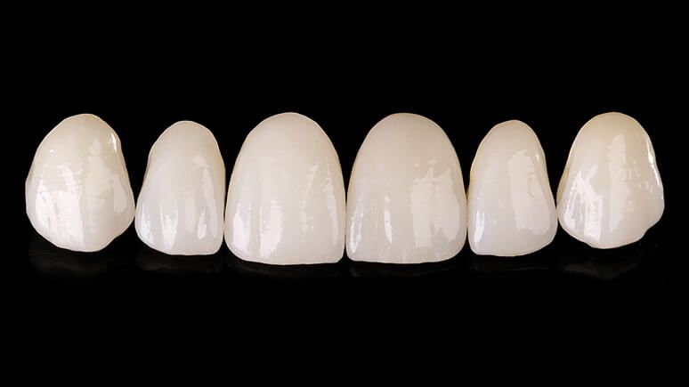 Циркониевые коронки на передние зубы из циркония PRETTAU