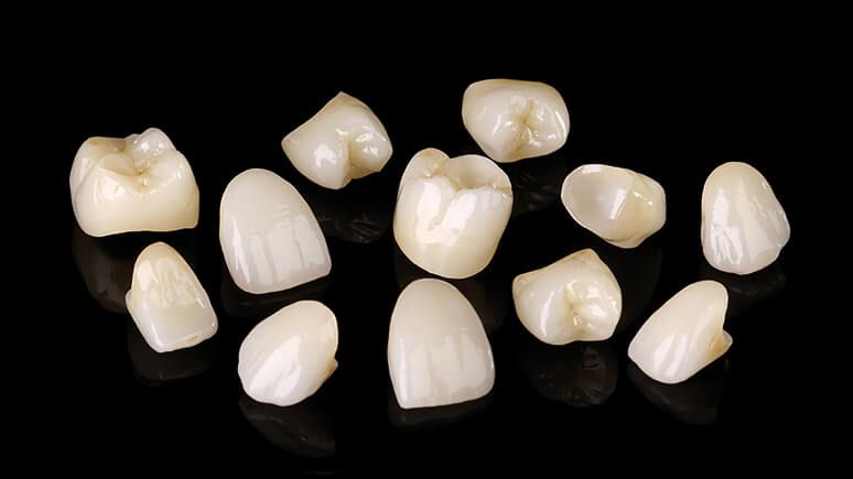 Циркониевые коронки на все зубы из циркония PRETTAU