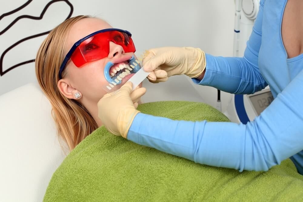 определение оттенка зубов до отбеливания