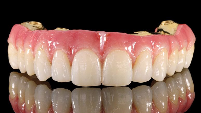 Полный зубной ряд для протезирования All-on-4