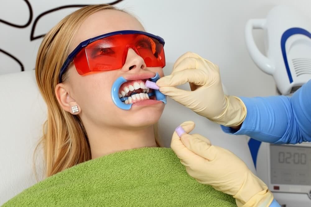удаление данного средства с поверхности зубов после отбеливания